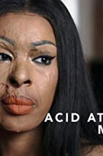 Acid Attack: My Story